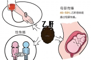 夫妻之间，传染乙肝的几率大吗? 
