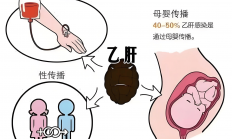夫妻之间，传染乙肝的几率大吗? 