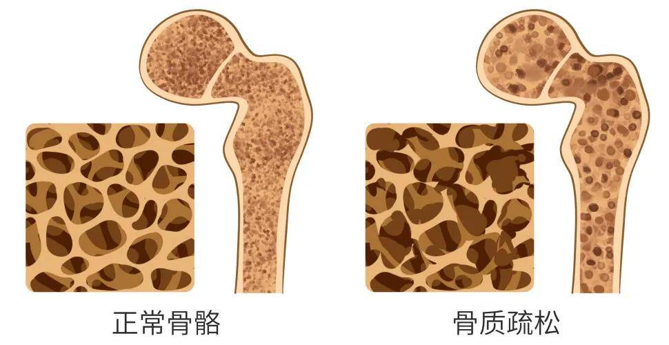 更年期该怎么补营养？营养师定制食谱来喽  更年期该怎么补营养 营养师 定制食谱 第2张