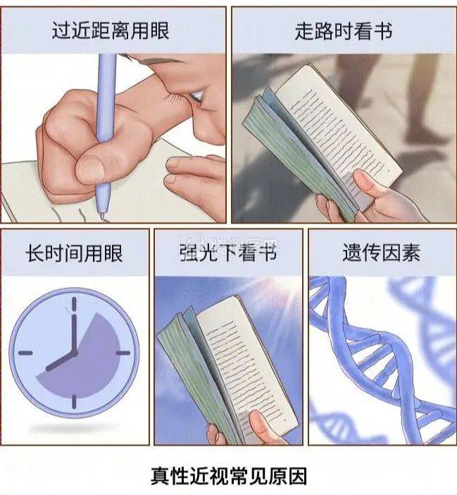 娃近视多少度需要戴眼镜？  娃近视多少度需要戴眼镜 第3张