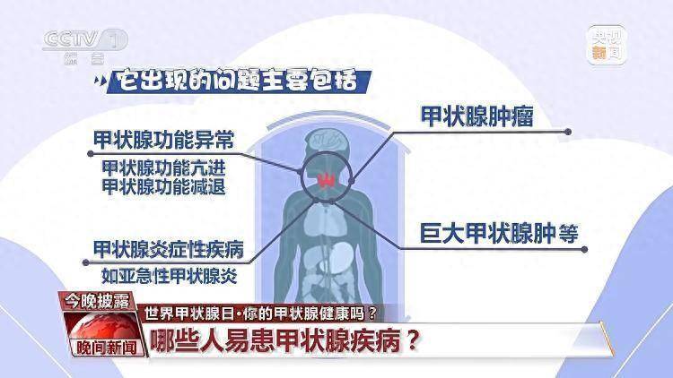 熬夜“熬”的是甲状腺的“寿命”！你的甲状腺健康吗？  熬夜 甲状腺 第1张