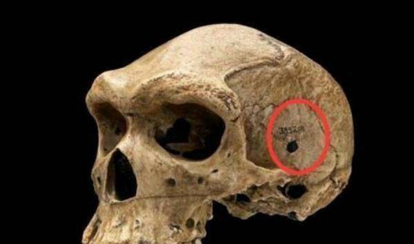 非洲发现古人类头骨，上面有个圆孔，专家：难道存在史前文明？  非洲古人类头骨 史前文明 第2张