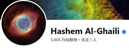 惊悚AI换头手术！不断移植人头实现永生：真相是什么 AI换头手术 第7张