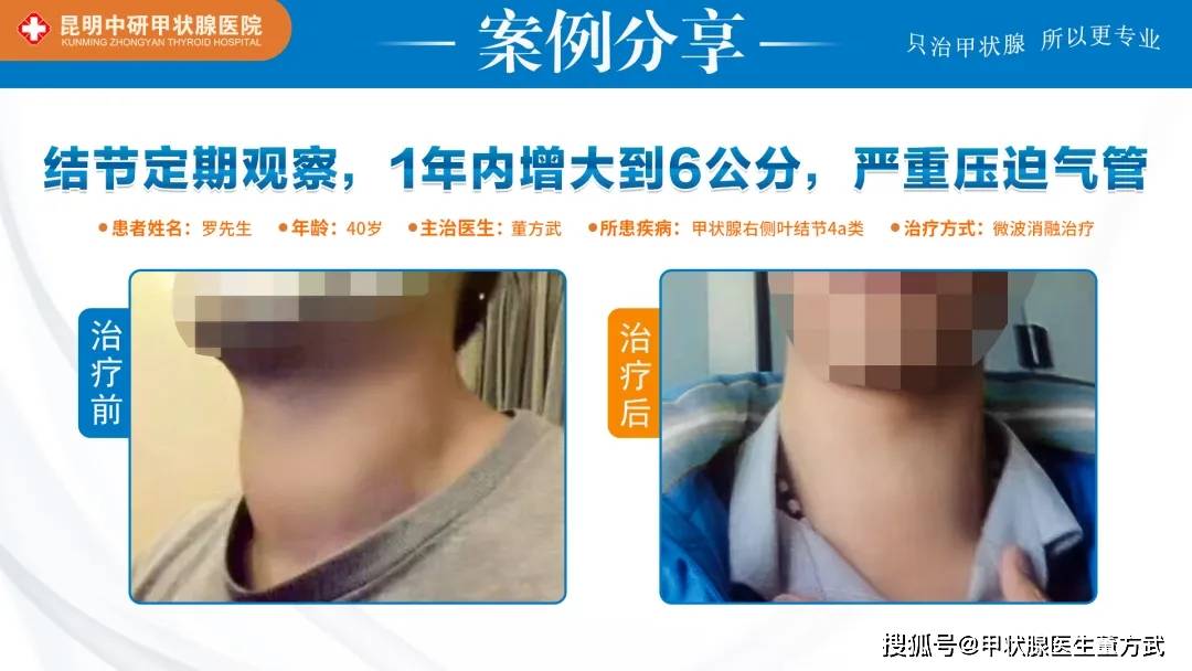 甲状腺结节患者平时该怎么吃？  甲状腺结节 第4张