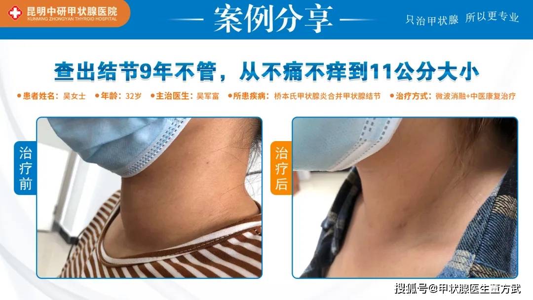 甲状腺结节患者平时该怎么吃？  甲状腺结节 第5张