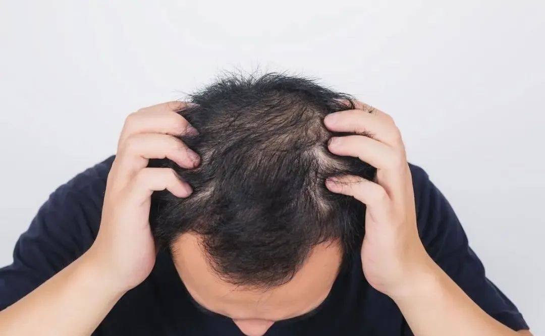 男性也会有更年期？是真的！出现这几种情况就说明更年期到了……  男性更年期 第1张