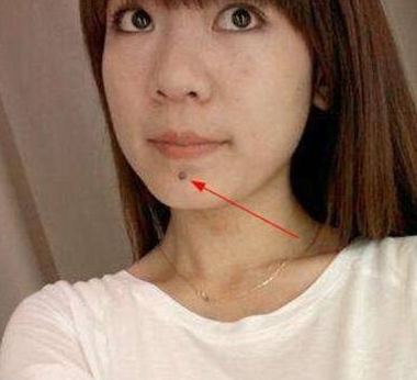 痣相算命：嘴巴周围长痣看运势，象征财旺福厚的吉痣，你有吗  痣相算命 第5张