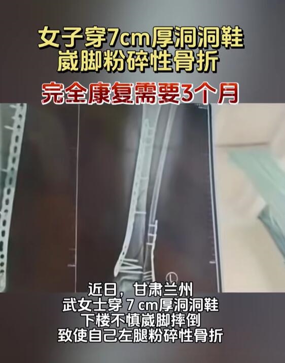 女子穿7cm厚洞洞鞋崴脚粉碎性骨折：完全康复需3个月 7cm厚洞洞鞋 崴脚粉碎性骨折 第2张
