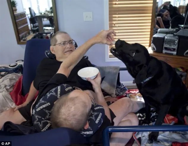 腹部相连只能轮流睡觉：世界最长寿男性连体双胞胎 68岁同时去世 世界最长寿男性连体双胞胎 第5张