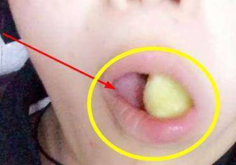 每天早晨吃片姜，坚持一段时间，你的身体可能会发生这4个改变！  吃姜 第2张