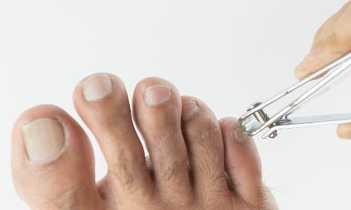 肾好不好看看脚？若脚上没有3个“信号”，恭喜，你的肾脏很健康  肾脏 第2张