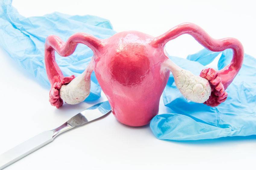 什么是子宫腺肌症？可选择三种方式治疗！ 子宫腺肌症 第4张