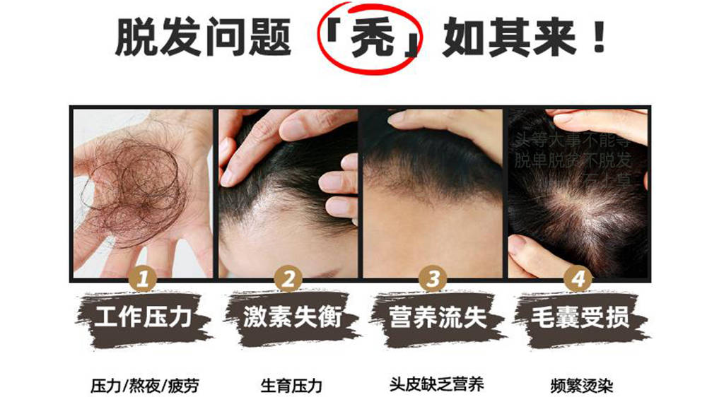 掉头发用什么洗发水?这洗发水放大招 掉头发 洗发水 第1张