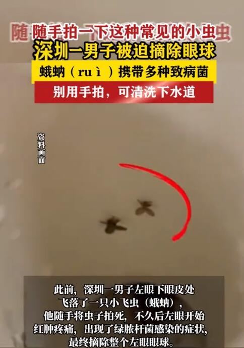 随手拍死蛾蚋 男子被迫摘除眼球：出现了绿脓杆菌感染症状 拍死蛾蚋 摘除眼球 绿脓杆菌感染 第2张