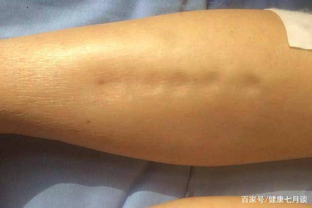 晨起后，男人身体若出现这5个症状，当心，你的肾需要赶紧滋补了  肾 第4张