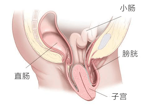 导致女性朋友子宫脱垂的元凶  子宫脱垂 第1张