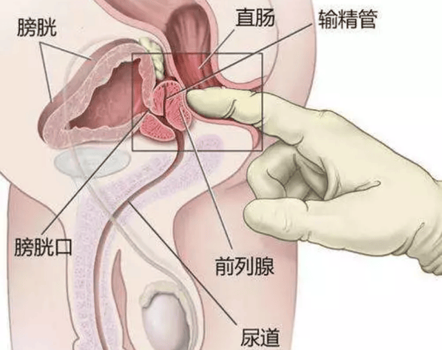 啊！这项运动，可能会影响生殖健康？  生殖健康 第2张