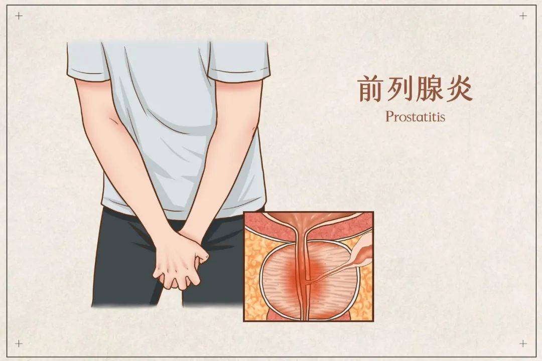 啊！这项运动，可能会影响生殖健康？  生殖健康 第3张