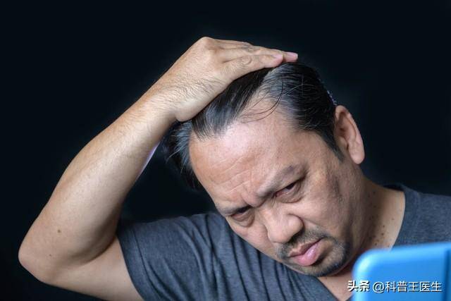中年男性脱发与性功能减退，你忽视了这个危机吗？  中年男性脱发 性功能减退 第3张