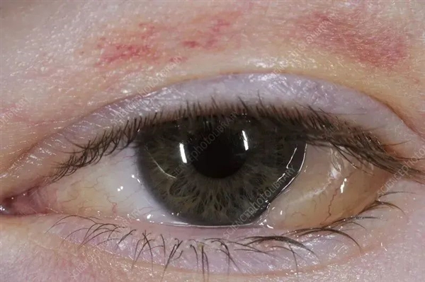 这4个“毁眼”行为不要再做了！再不注意 眼睛真的要废了 毁眼 眼睛 第1张
