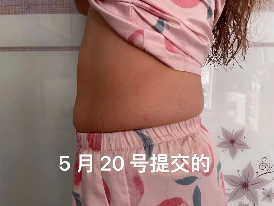 不调菌群,减重可能变成减命? 菌群 减重 第4张 不调菌群,减重可能变成减命? 菌群 减重 第4张
