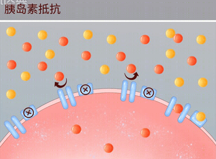 一少吃,就手抖?警惕胰岛素抵抗的微妙信号 胰岛素抵抗 第2张 一少吃,就手抖?警惕胰岛素抵抗的微妙信号 胰岛素抵抗 第2张