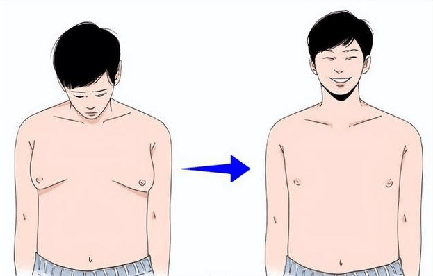 男性“胸”大要重视，可能会有这些隐患 男性胸大要重视 第1张