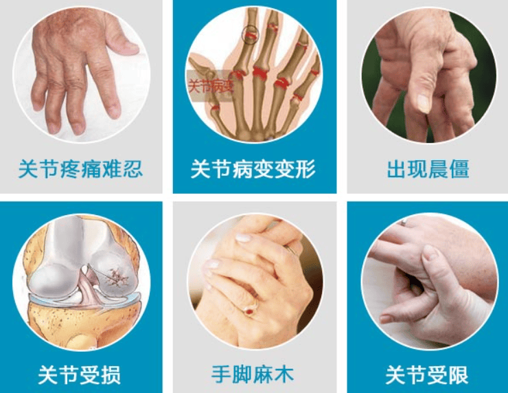 硬皮病必看！常吃3种食物，赶走关节疼痛、僵硬！ 硬皮病 第1张