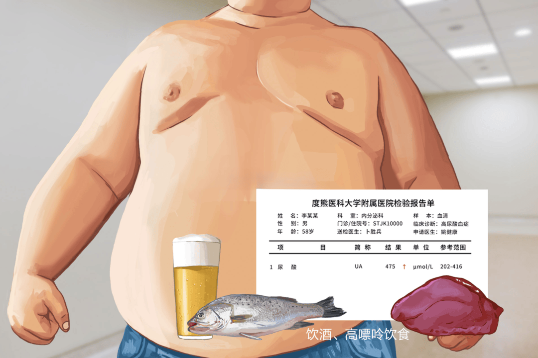 有人说高尿酸是吃出来的，真的是这样吗？ 高尿酸 第1张