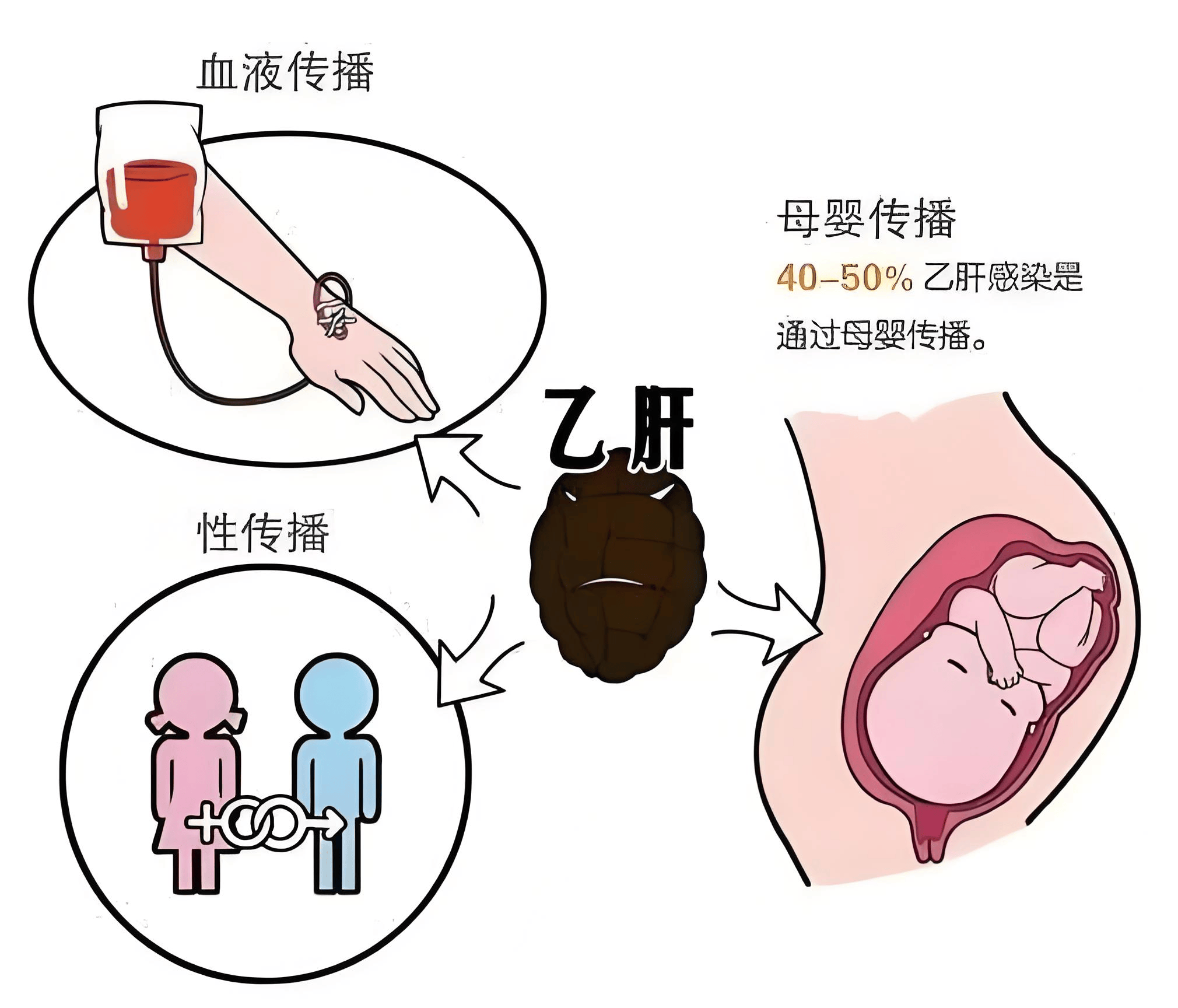 夫妻之间，传染乙肝的几率大吗?  传染乙肝 第1张