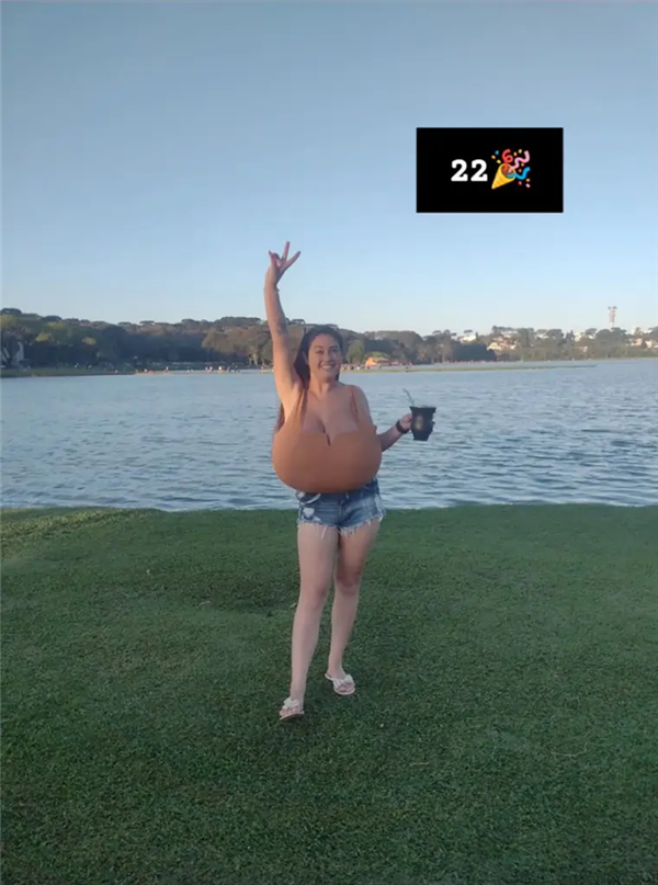 巴西女子患“巨乳症”失控!短短几月长O杯 出行得坐轮椅 巨乳症 第3张 巴西女子患“巨乳症”失控!短短几月长O杯 出行得坐轮椅 巨乳症 第3张