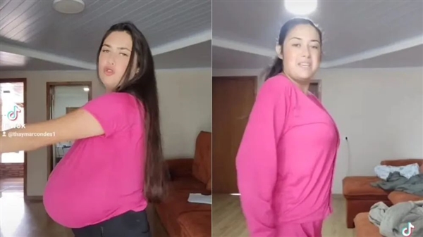 巴西女子患“巨乳症”失控!短短几月长O杯 出行得坐轮椅 巨乳症 第4张 巴西女子患“巨乳症”失控!短短几月长O杯 出行得坐轮椅 巨乳症 第4张