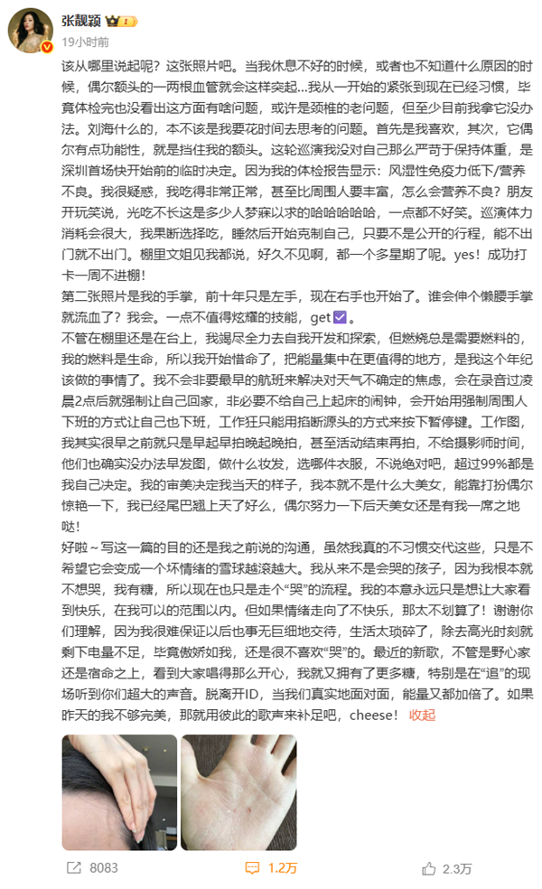 张靓颖自曝体检查出营养不良:额头血管莫名突起 伸懒腰手掌就流血 张靓颖 第3张 张靓颖自曝体检查出营养不良:额头血管莫名突起 伸懒腰手掌就流血 张靓颖 第3张